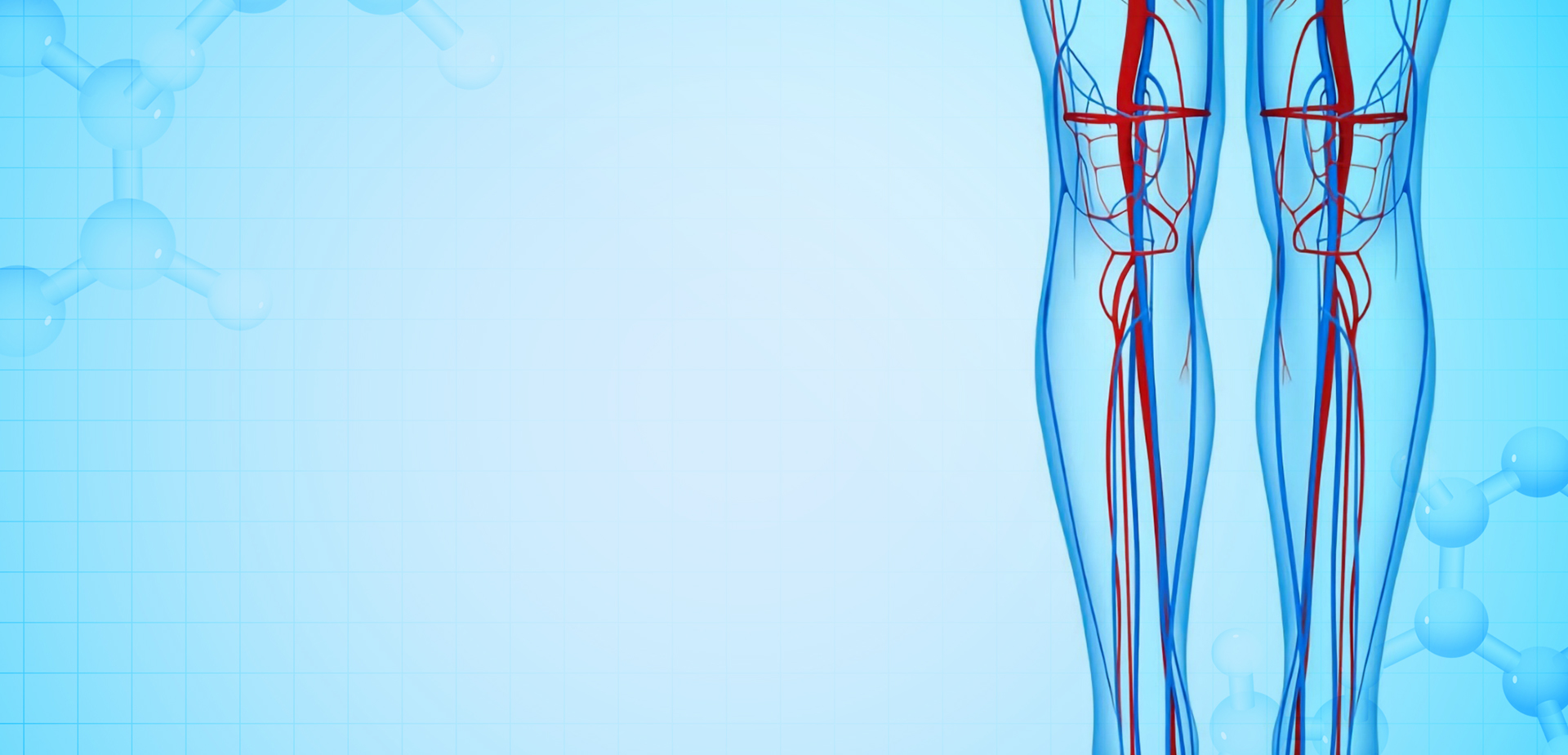 নিংবো লিন্সট্যান্ট পলিমার উপকরণ CO,. LTD.