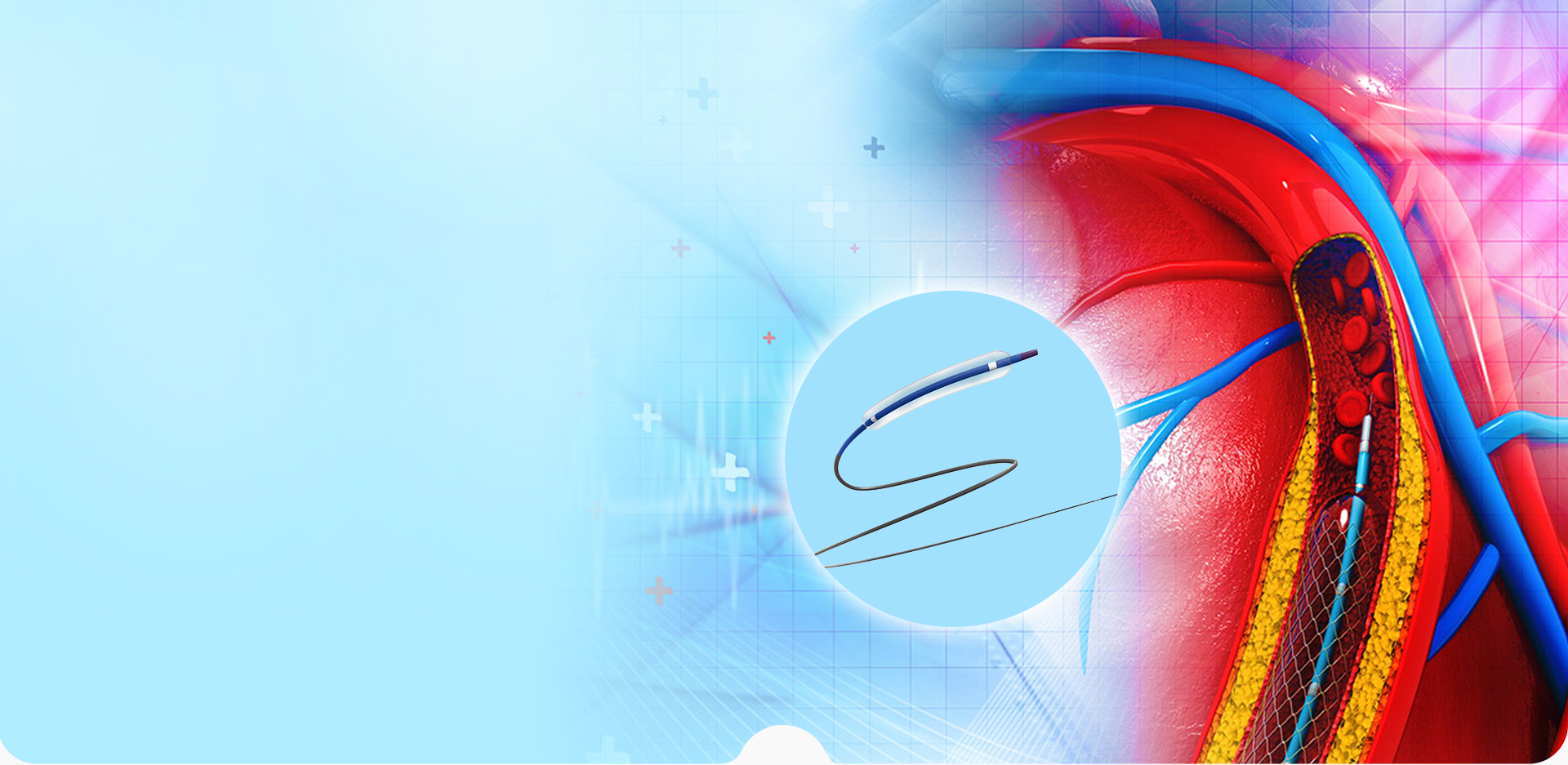 নিংবো লিন্সট্যান্ট পলিমার উপকরণ CO,. LTD.