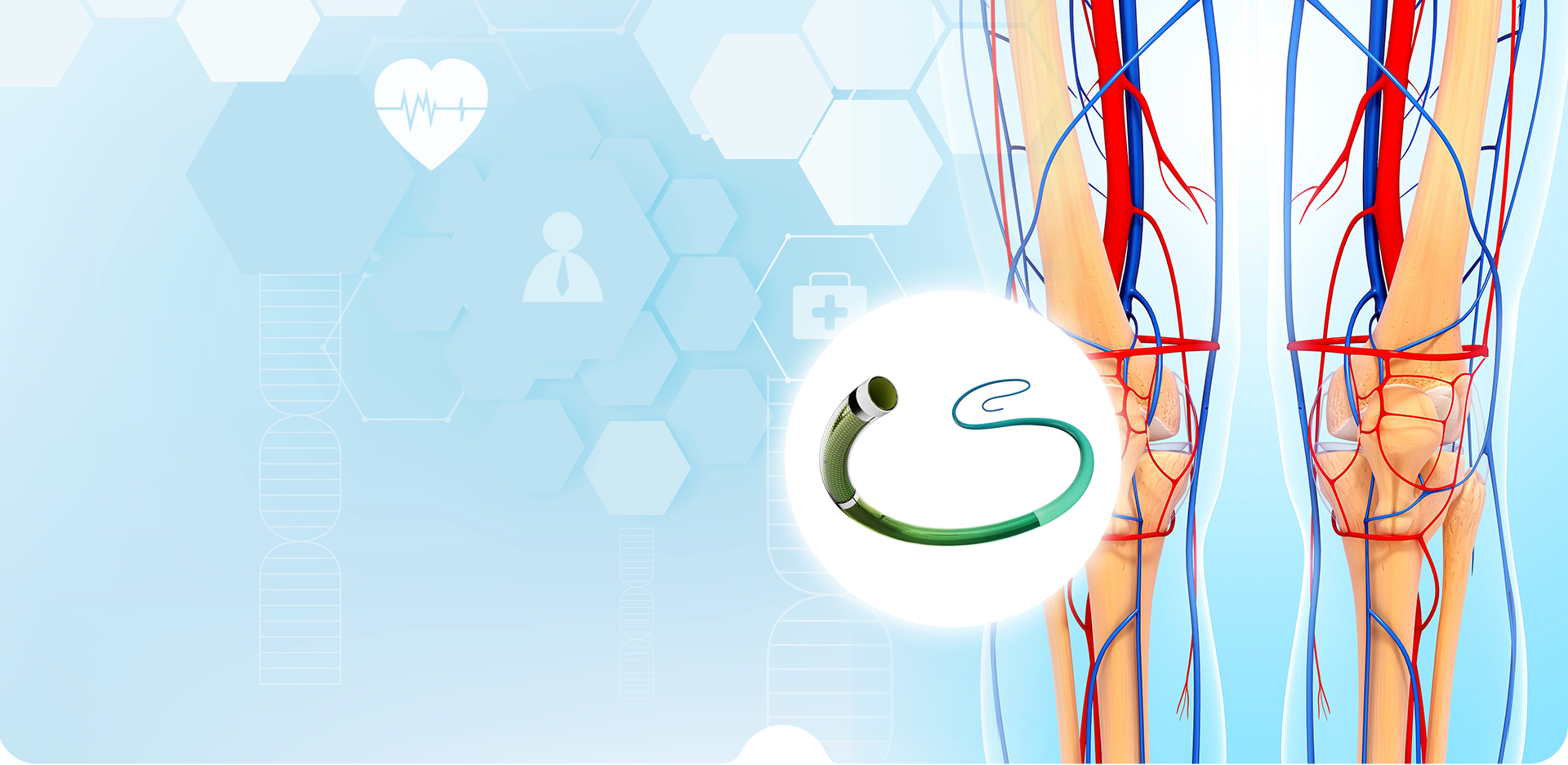 নিংবো লিন্সট্যান্ট পলিমার উপকরণ CO,. LTD.